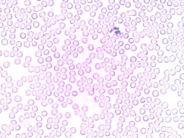 neutrofilní granulocyty